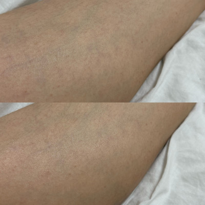 포토후기